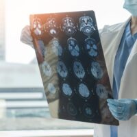 Brain disease diagnosis with medical doctor seeing Magnetic Resonance Imaging (MRI) film diagnosing elderly ageing patient neurodegenerative illness problem for neurological medical treatment Brain disease diagnosis with medical doctor seeing Magnetic Resonance Imaging (MRI) film diagnosing elderly ageing patient neurodegenerative illness problem for neurological medical treatment